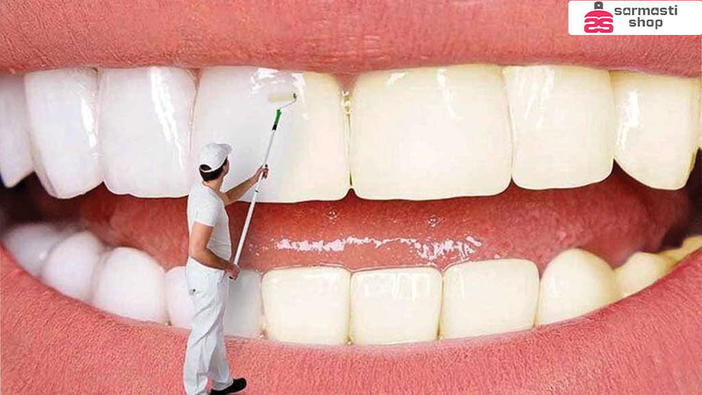 جرم دندان چگونه پاک میشود؟