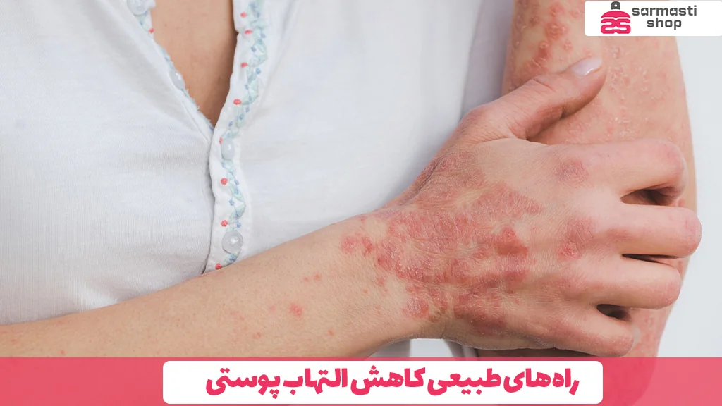 راه‌های طبیعی کاهش التهاب پوستی