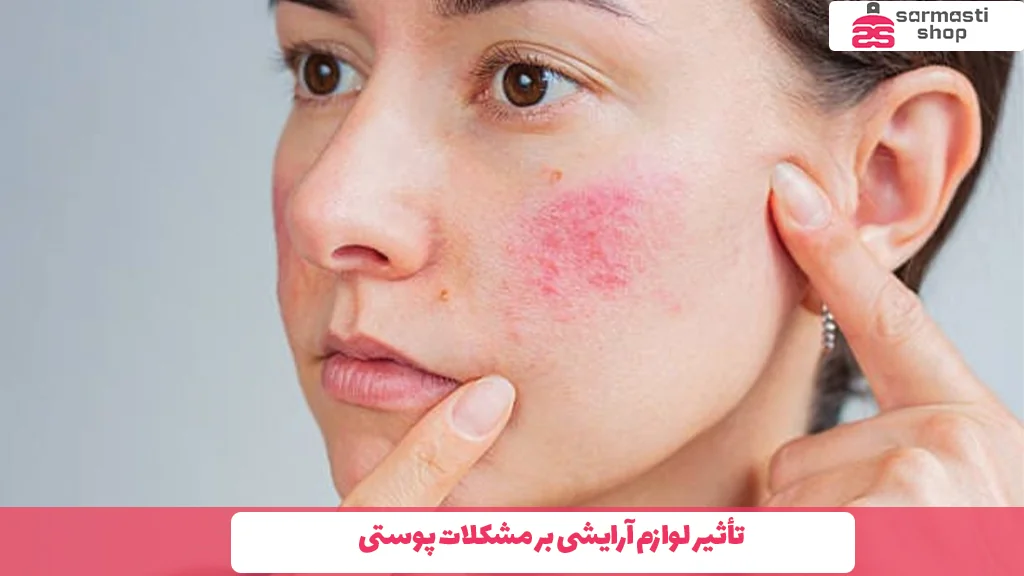 تأثیر لوازم آرایشی بر مشکلات پوستی