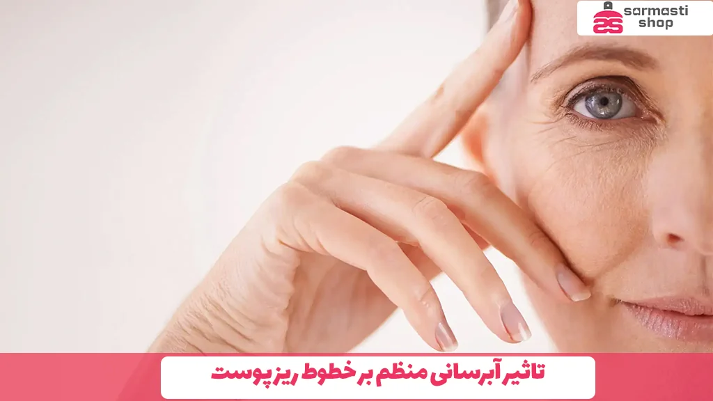 تاثیر آبرسانی منظم بر خطوط ریز پوست