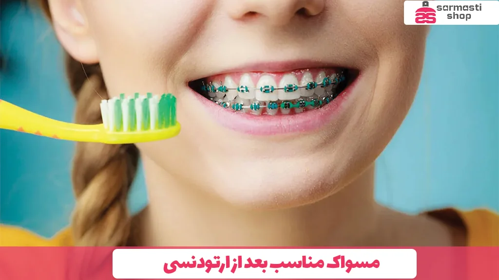 مسواک مناسب بعد از ارتودنسی 