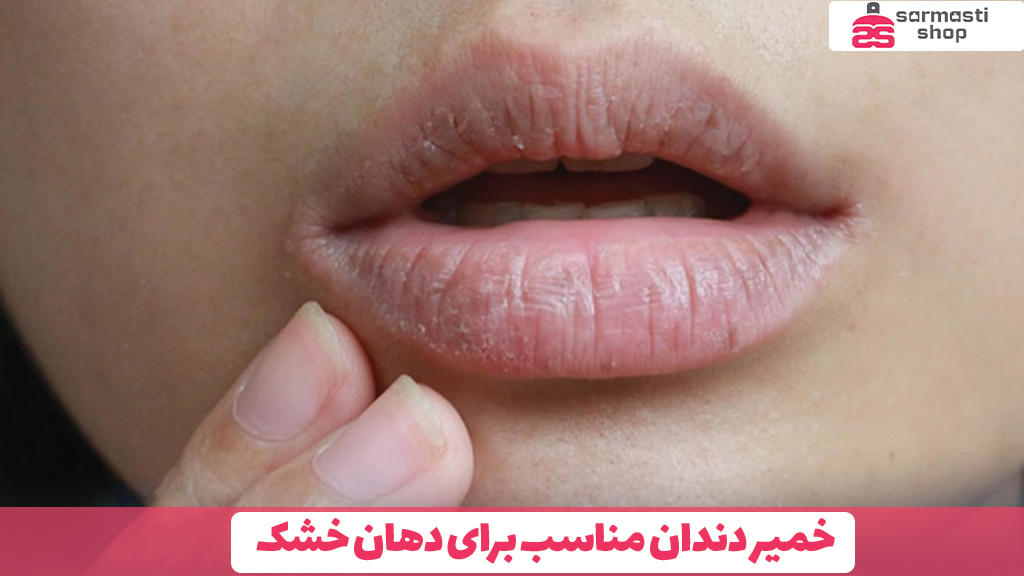 خمیر دندان مناسب برای دهان خشک