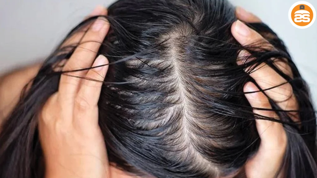 علت چرب شدن مو چیست؟